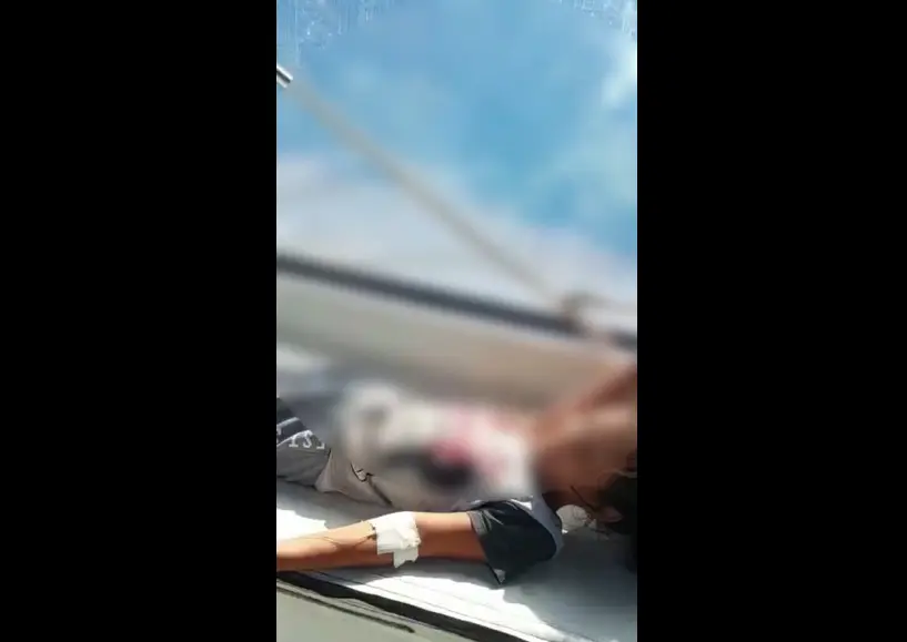 Criança é picada por jararaca dentro de casa em Guaraqueçaba